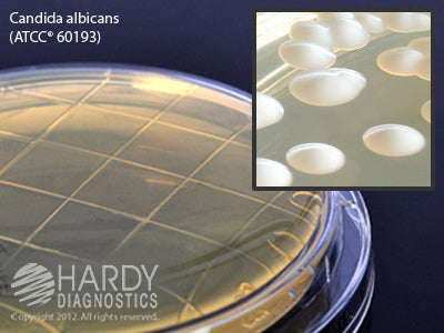 P36: Sabdex (Sabouraud Dextrose) Agar, contact plate with Lok-Tight™ friction lid, optional locking feature, order by the package of 10